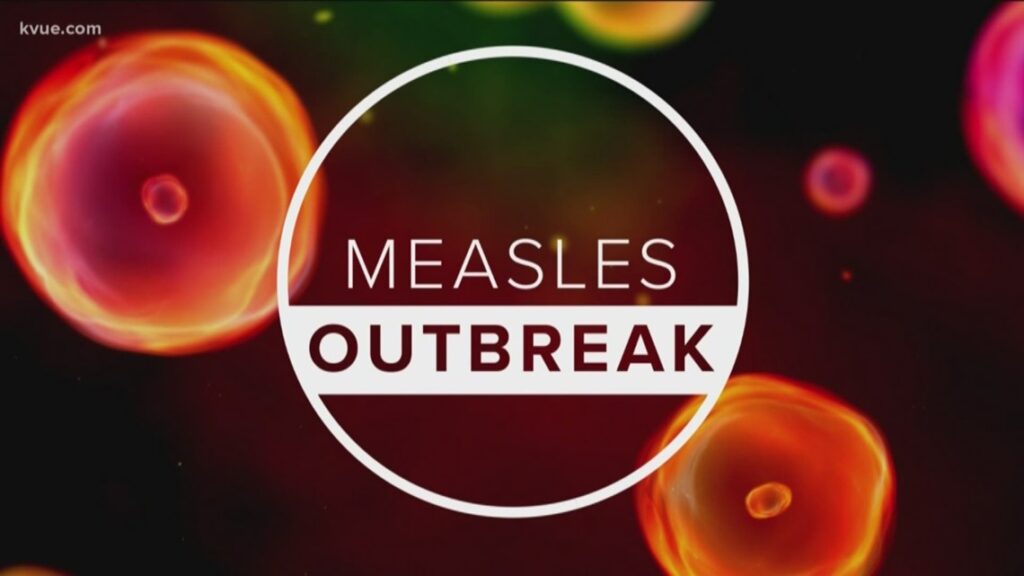 Potential measles exposure in Hays County linked to recent San Marcos visit