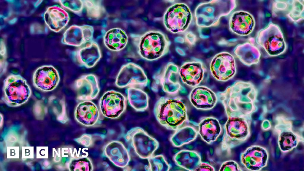 US measles outbreak sickens nearly 100 in Texas, New Mexico