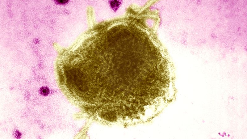 West Texas measles outbreak doubles to 48 cases
