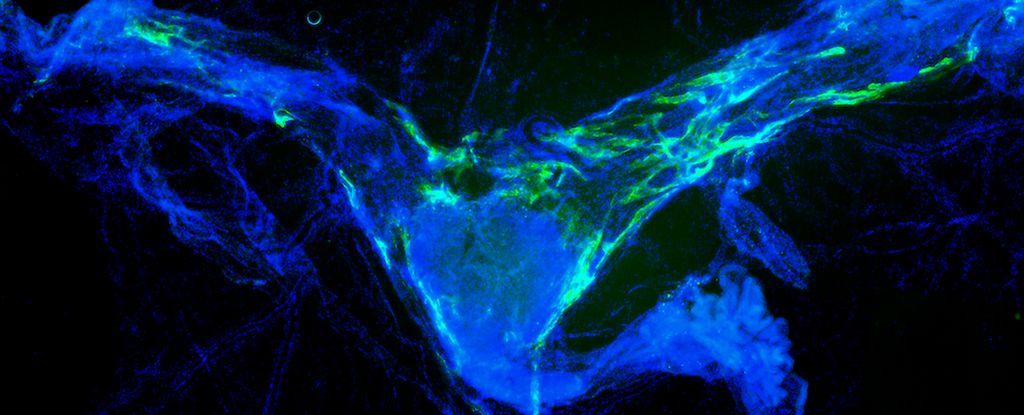 Clearing Brain Waste Dramatically Improves Memory in Aging Mice : ScienceAlert
