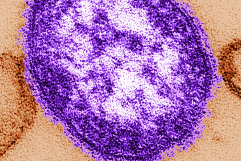 DC Health officials confirm measles case in the District