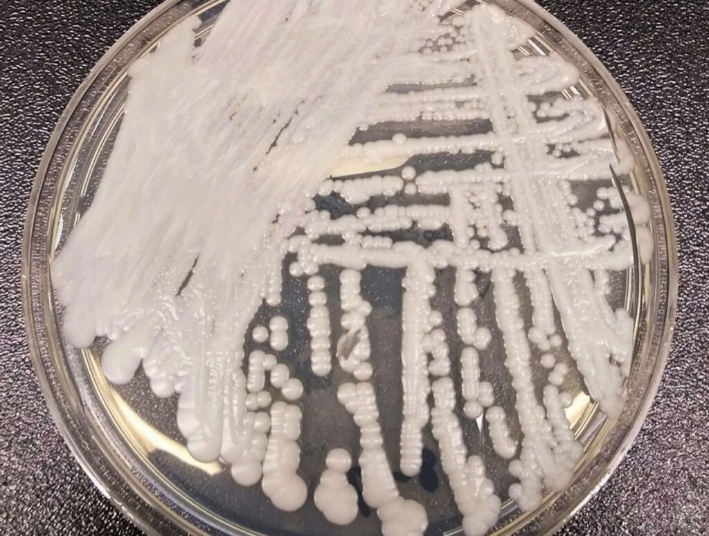 This deadly, drug-resistant fungus is spreading. What you need to know.