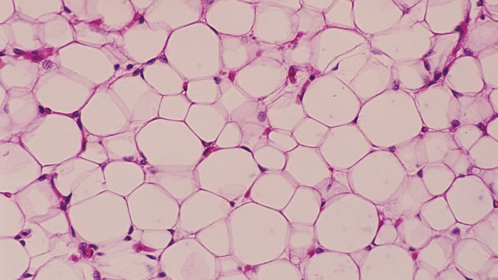 Scientists describe new type of fat in human bellies