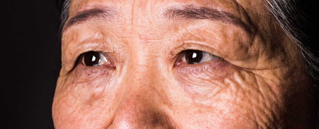 Your Vision Can Predict Dementia 12 Years Before Diagnosis, Study Discovers : ScienceAlert