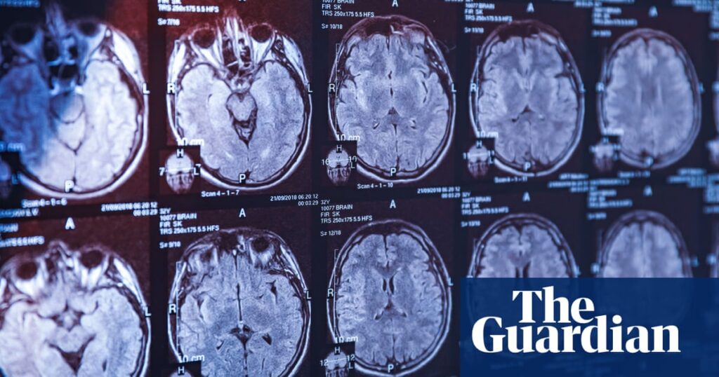 Blood test could detect Parkinson’s disease before symptoms emerge | Parkinson's disease