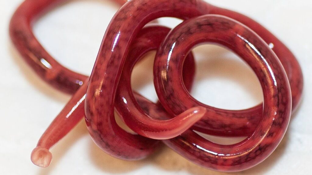 Unable to urinate for two days, a patient was found to have a 12-inch worm living in his kidney.
