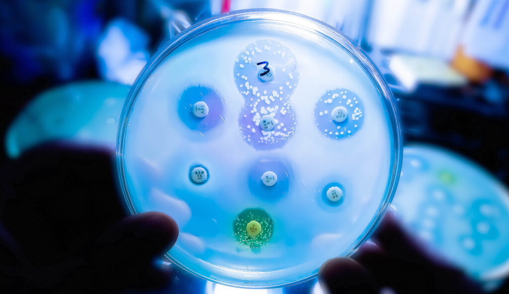 New "superbugs" discovered in hospitals eat medical plastics