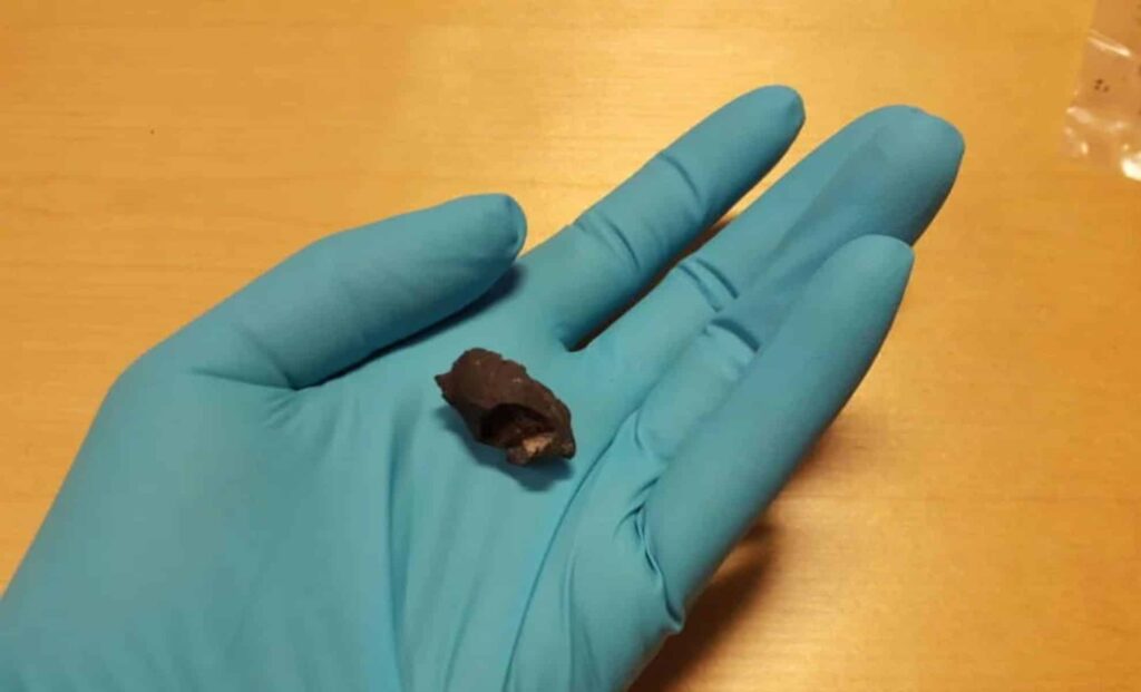 Archaeologists Shocked by Ancient DNA in Prehistoric Gum Found in Sweden