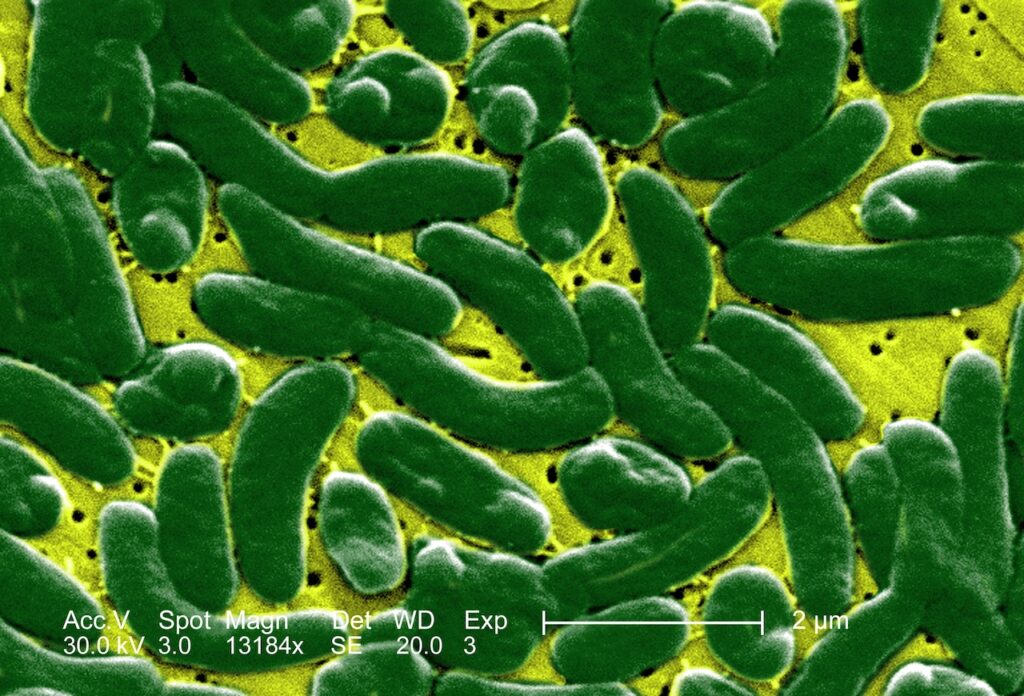 4 people have died from flesh-eating bacteria in Florida: Who is at risk?