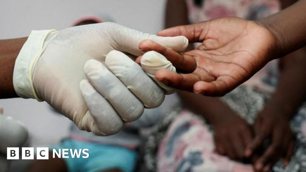 South Africa's HIV/Aids patients worry about treatment