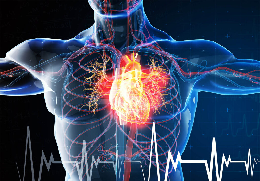 Study concludes that heart attacks "may be an infectious disease"
