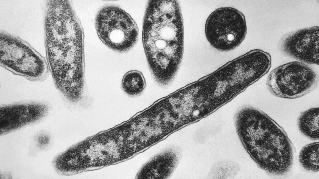 6th death reported in Legionnaires' disease outbreak in New York City