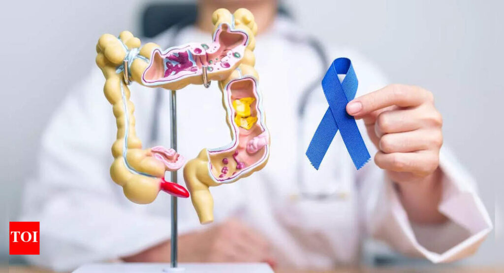 Colon cancer doctor shares five life-saving lessons: Symptoms and risks you should know |
