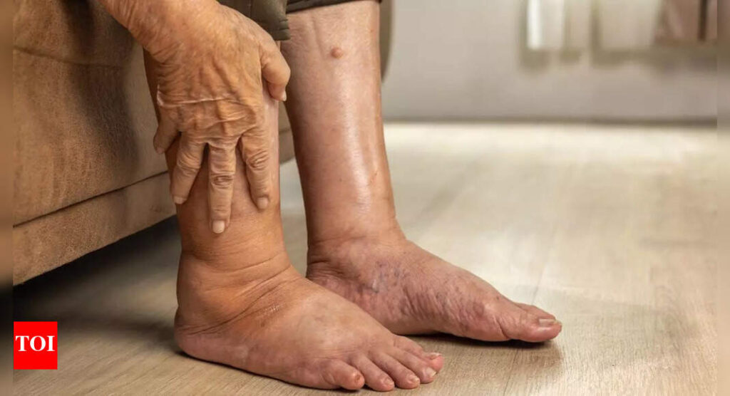 Pancreatic cancer: 4 warning signs in your legs that you shouldn't ignore |