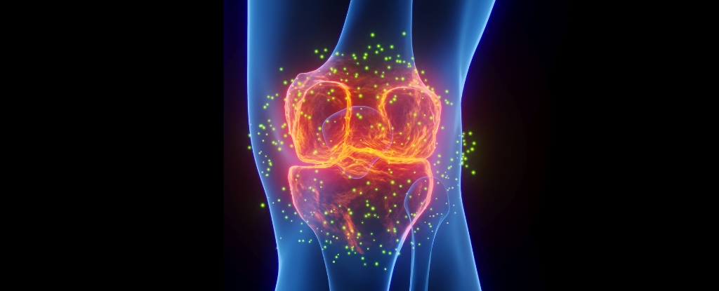 The Best Medicine For Joint Pain Isn't What You Think, Expert Says : ScienceAlert