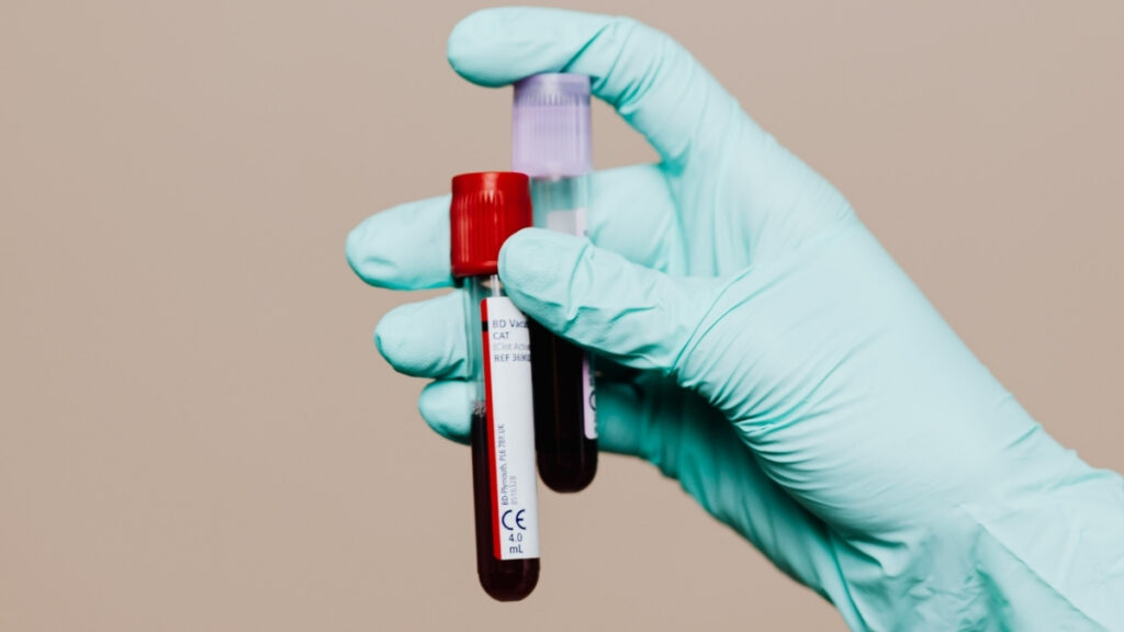 New Chronic Fatigue Syndrome 'Blood Test' Raises Hope And Skepticism : ScienceAlert
