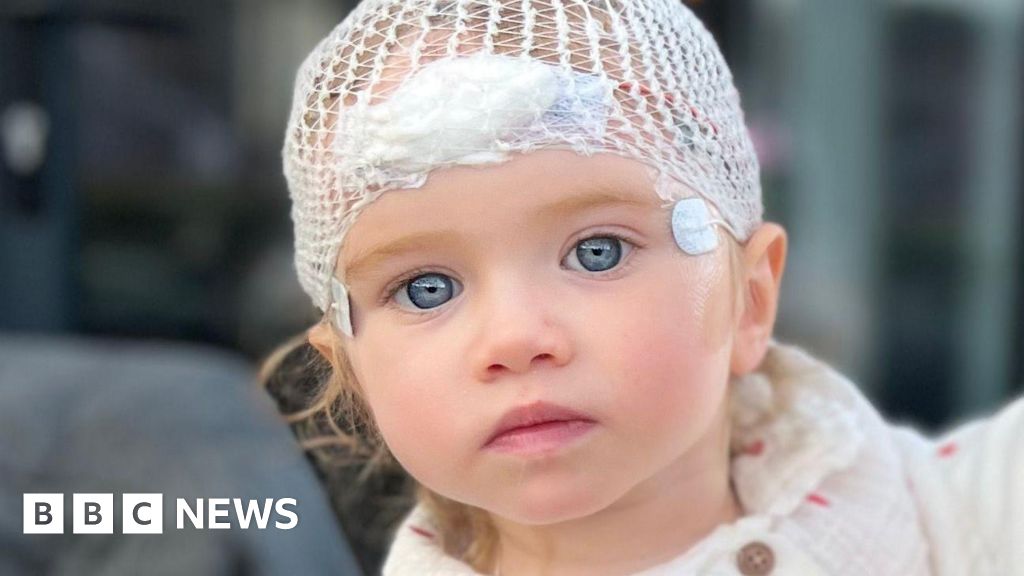Parents of critically ill child express deep fatigue following denial of respite care services