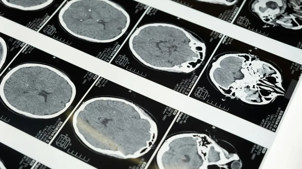 China creates non-invasive ultrasound technology for brain-computer communication.