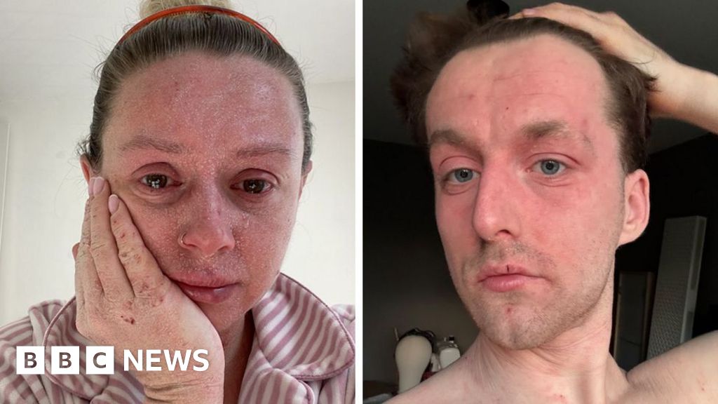 Mysterious skin condition affects individuals, leaving them seeking answers.