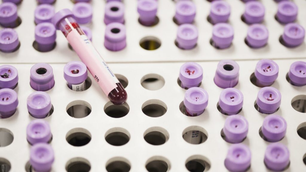 Revised recommendations provided for the management of elevated cholesterol levels.
