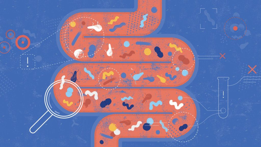 Factors Contributing to Increased Colorectal Cancer Rates Among Younger Individuals