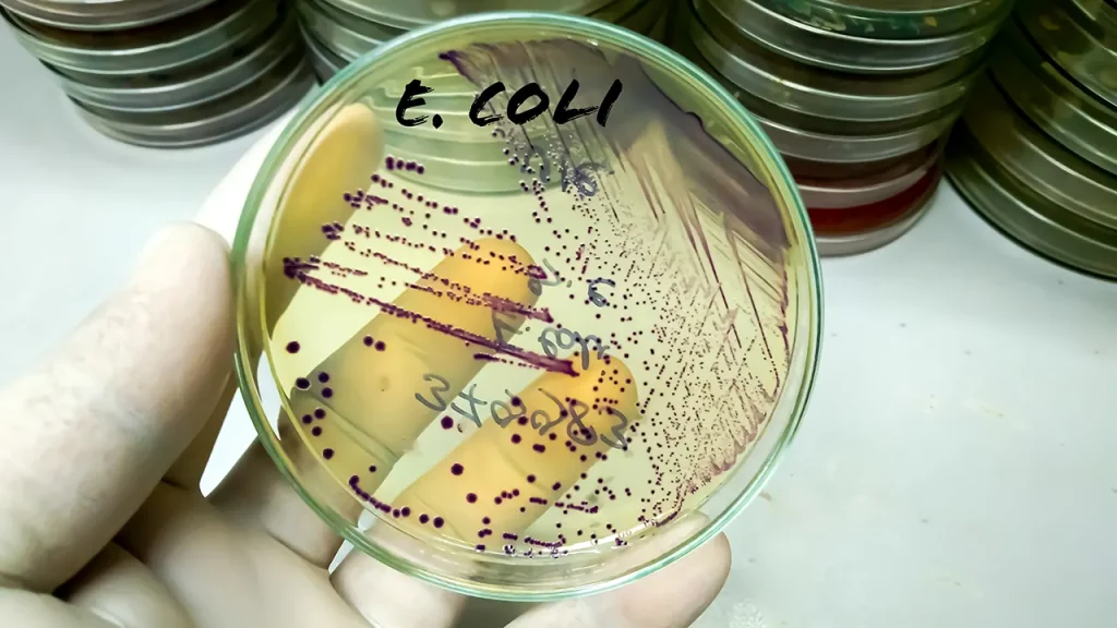 Indiana University scientist receives sentence for importing E. coli into the United States.