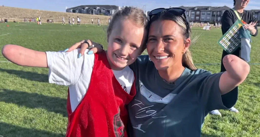 Inspiration from a Denver soccer player motivates a girl born with a partial limb.