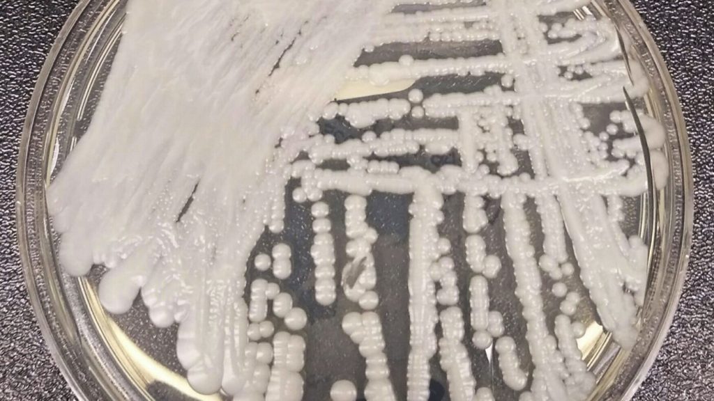Researchers express concerns over the rise of drug-resistant fungi.