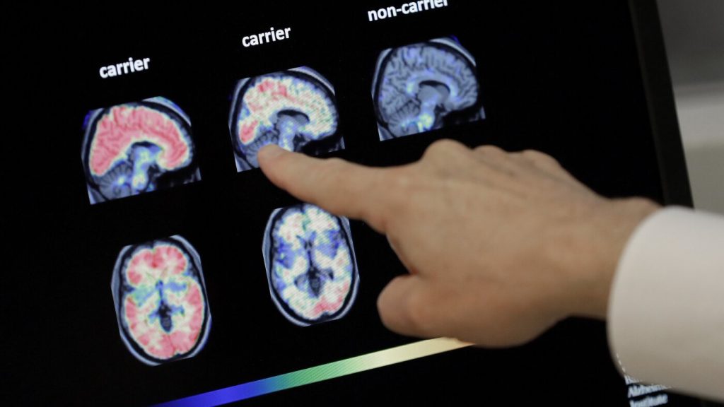 Exploring the Potential of Chinese AI in Addressing Inequality and the Financial Impact of Dementia